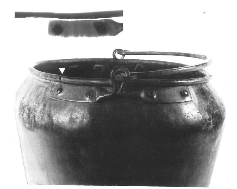 Röntgenfoto des Gefäßrandes.