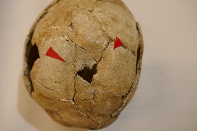 Das Bild zeigt die Draufsicht auf einen menschlichen Schädel aus der Jungsteinzeit. In der Mitte des Schädels befindet sich eine trapezförmige Öffnung, eine sogenannte Trepanation. Zwei rote Pfeile markieren den Rand dieser künstlich geschaffenen Öffnung. Der Schädel ist stark rissig, aber fast vollständig erhalten.