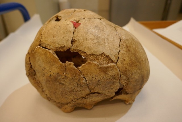 Das Bild zeigt einen stark beschädigten menschlichen Schädel aus der Jungsteinzeit. Eine große Öffnung oben auf dem Schädel deutet auf eine Trepanation hin. Zwei rote Pfeile markieren diese Stelle. Der Schädel ist von vielen Rissen durchzogen, liegt leicht schräg auf einer weißen Unterlage.