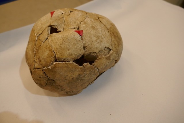 Das Bild zeigt einen menschlichen Schädel aus der Jungsteinzeit, der seitlich liegt. Auf dem oberen Bereich des Schädels befindet sich eine große künstliche Öffnung, eine Trepanation. Ein roter Pfeil markiert die Stelle. Der Schädel ist von vielen Rissen durchzogen, aber vollständig erhalten.