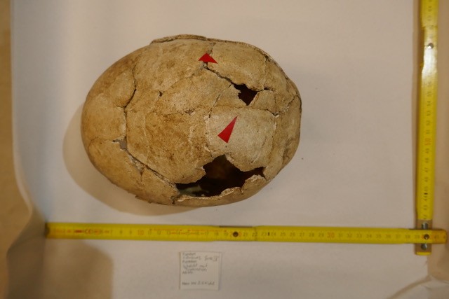 Das Foto zeigt einen echten menschlichen Schädel aus der Jungsteinzeit, gefunden im Großsteingrab Warburg IV. Der Schädel ist oben stark gebrochen, aber noch weitgehend vollständig. Zwei rote Pfeile zeigen auf eine Öffnung im Schädel, eine sogenannte Trepanation, also eine gezielte Bohrung oder Ausschabung. Das Bild enthält außerdem zwei Maßbänder zur Längenmessung und einen kleinen Zettel mit Fundinformationen.